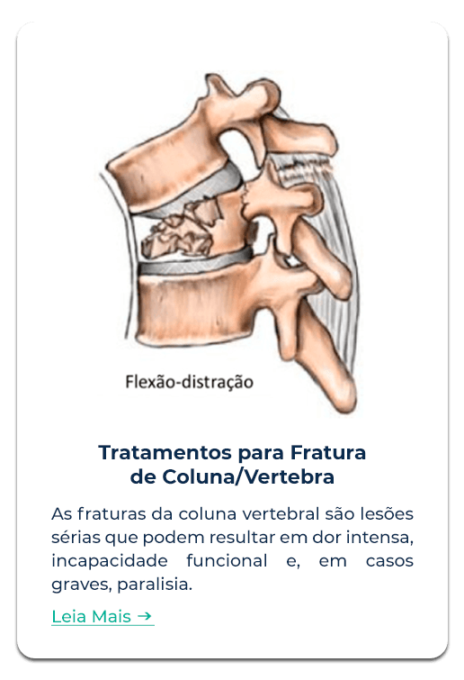 Tratamento Vertebra